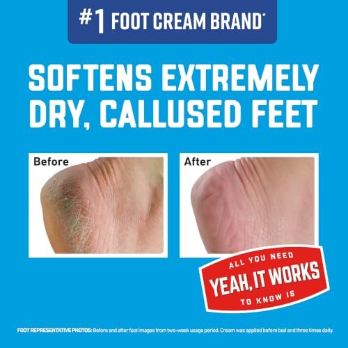 OKeeffes Healthy Feet Intense Renewal Cream, 3 oz Tube, 1-Pack